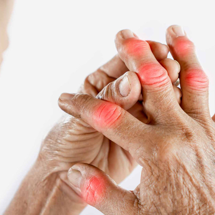 Why Does Joint Pain Increase In Winter?
