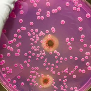 5 easy ways to banish yeast infections!