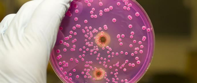 5 easy ways to banish yeast infections!