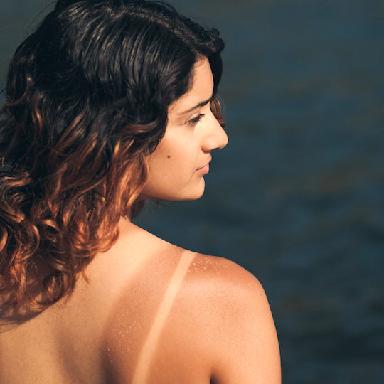 How to treat your sunburn naturally!